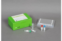 Accupower® Hiv-1 Quantitative Rt-pcr Kit