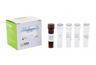 AccuPower® Actinomyces naeslundii Real-Time PCR Kit