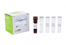 AccuPower® Actinomyces viscosus Real-Time PCR Kit
